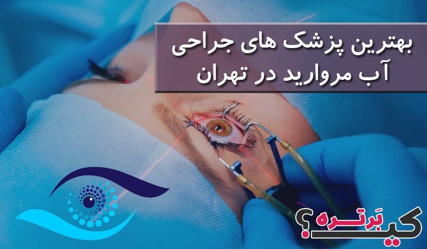 بهترین پزشک های جراحی آب مروارید در تهران