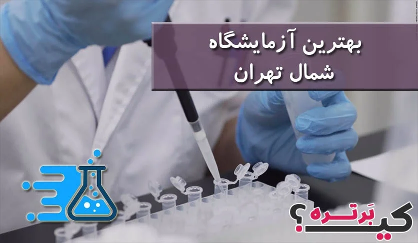بهترین آزمایشگاه های شمال تهران